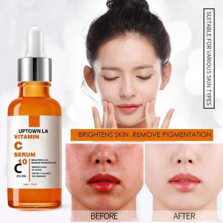 Uptown LA Vitamin C Brightening Serum (30ml) | Anti-Aging Face Serum with Hyaluronic Acid | Dark Spot Corrector & Glow Booster for All Skin Types