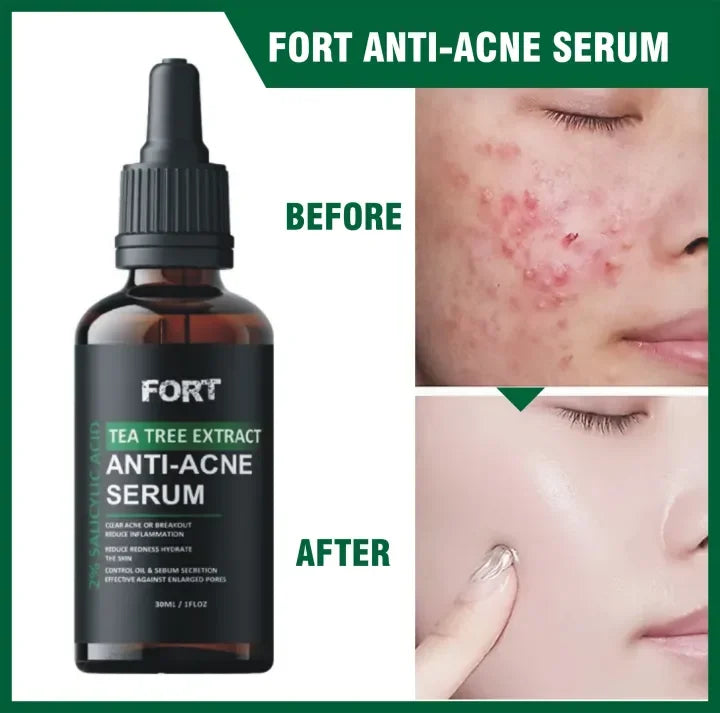 FORT Salicylic Acid Serum (30ml) – Anti-Acne & Dark Spot Corrector for Glass Skin